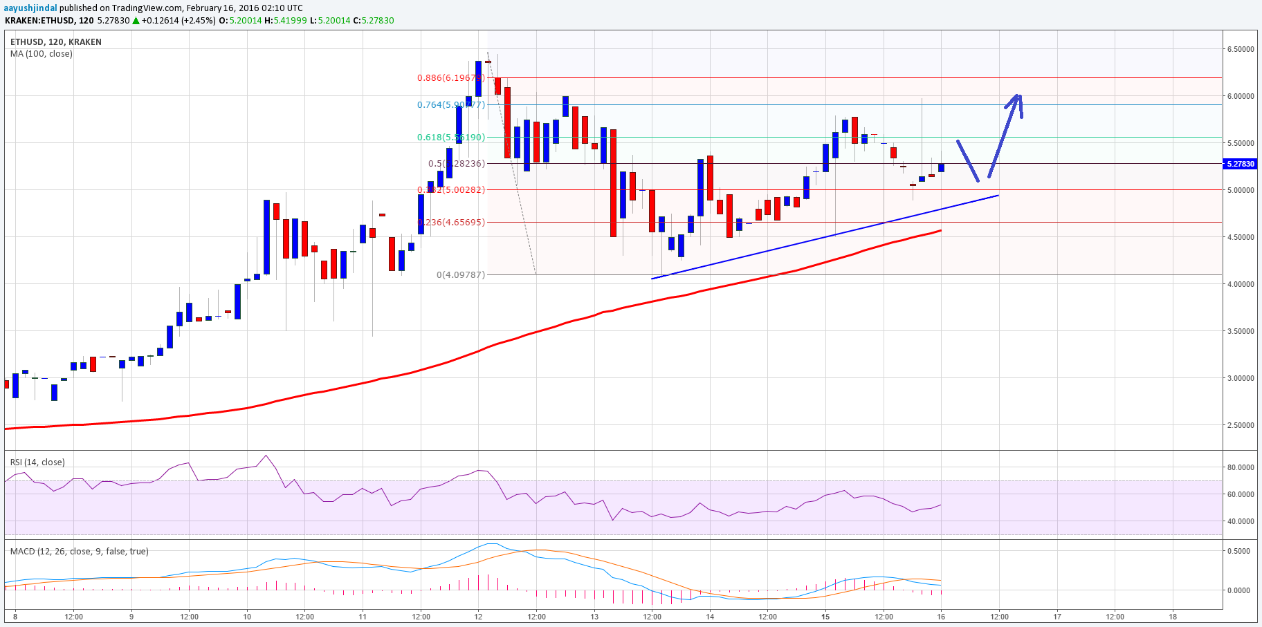 Ethereum Price Technical Analysis – Watch Out For 100 SMA