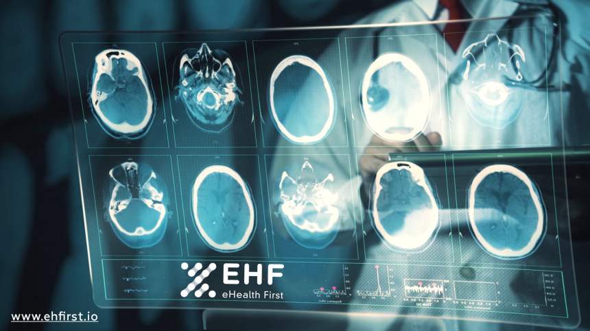 EHF