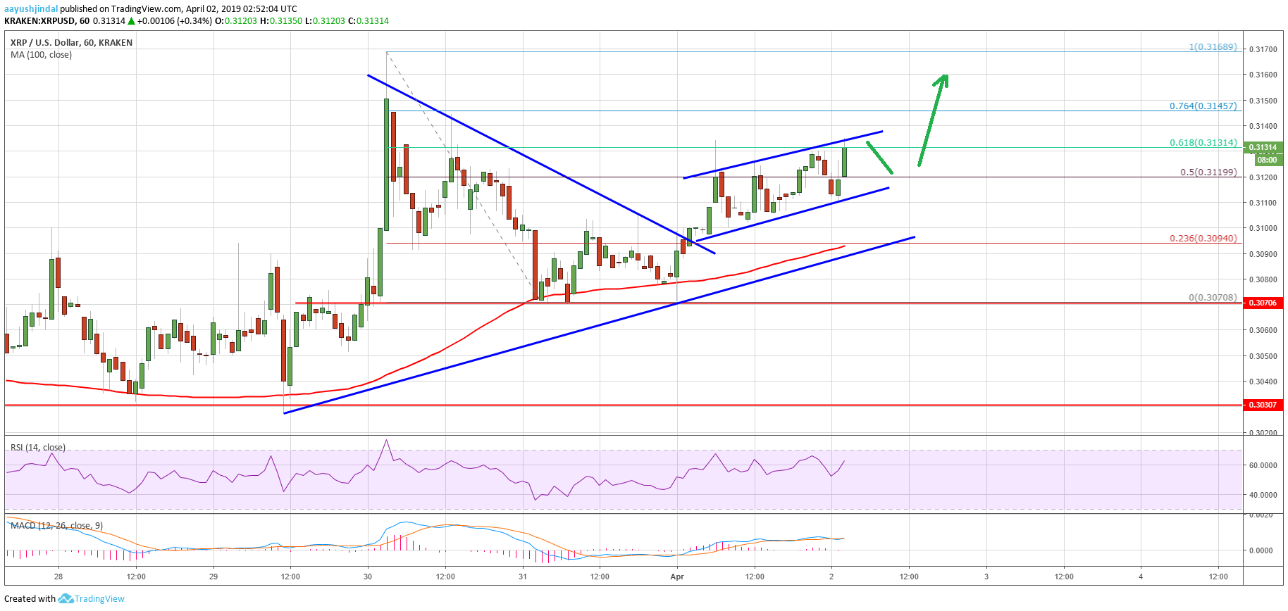 Ripple Price Analysis XRP Chart