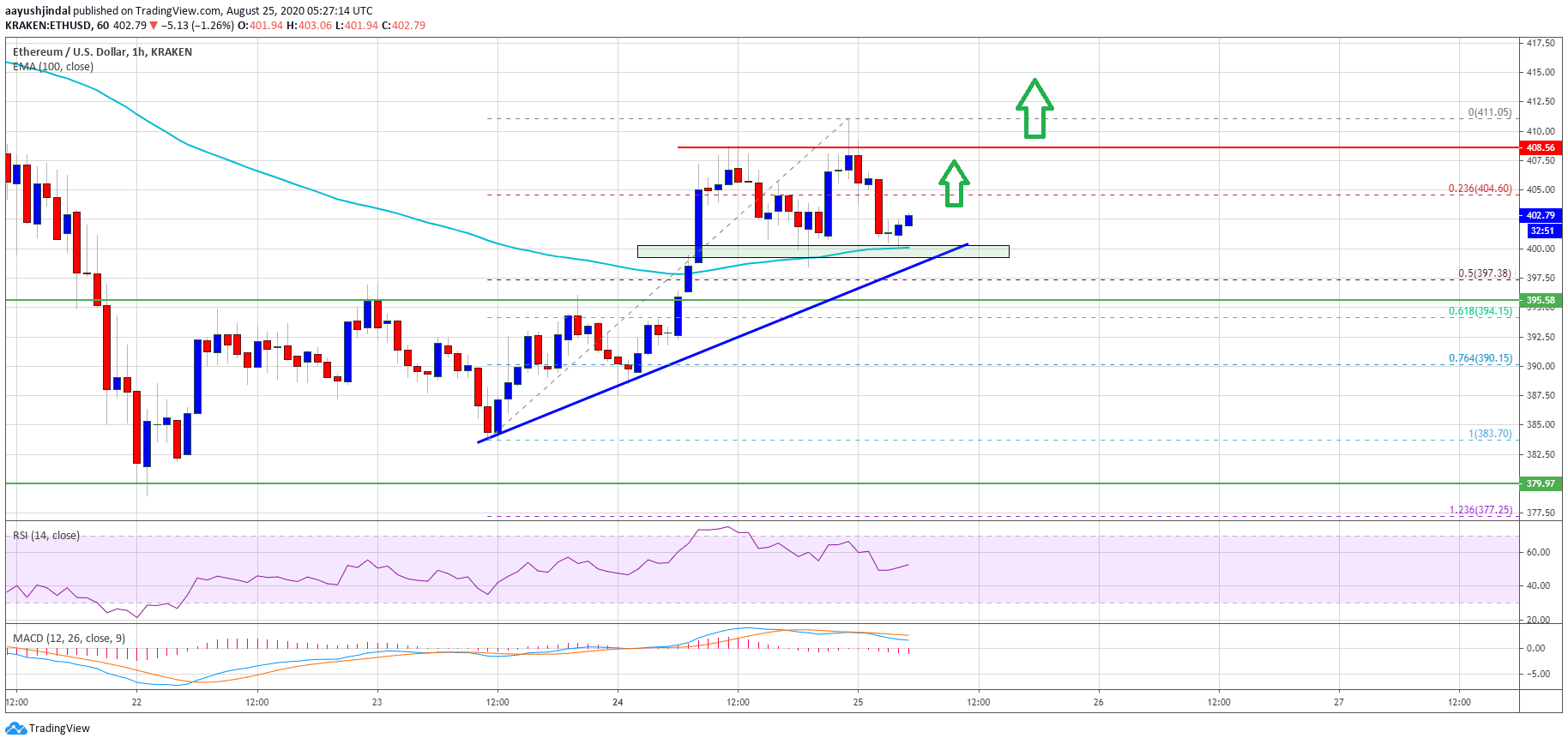 سعر Ethereum