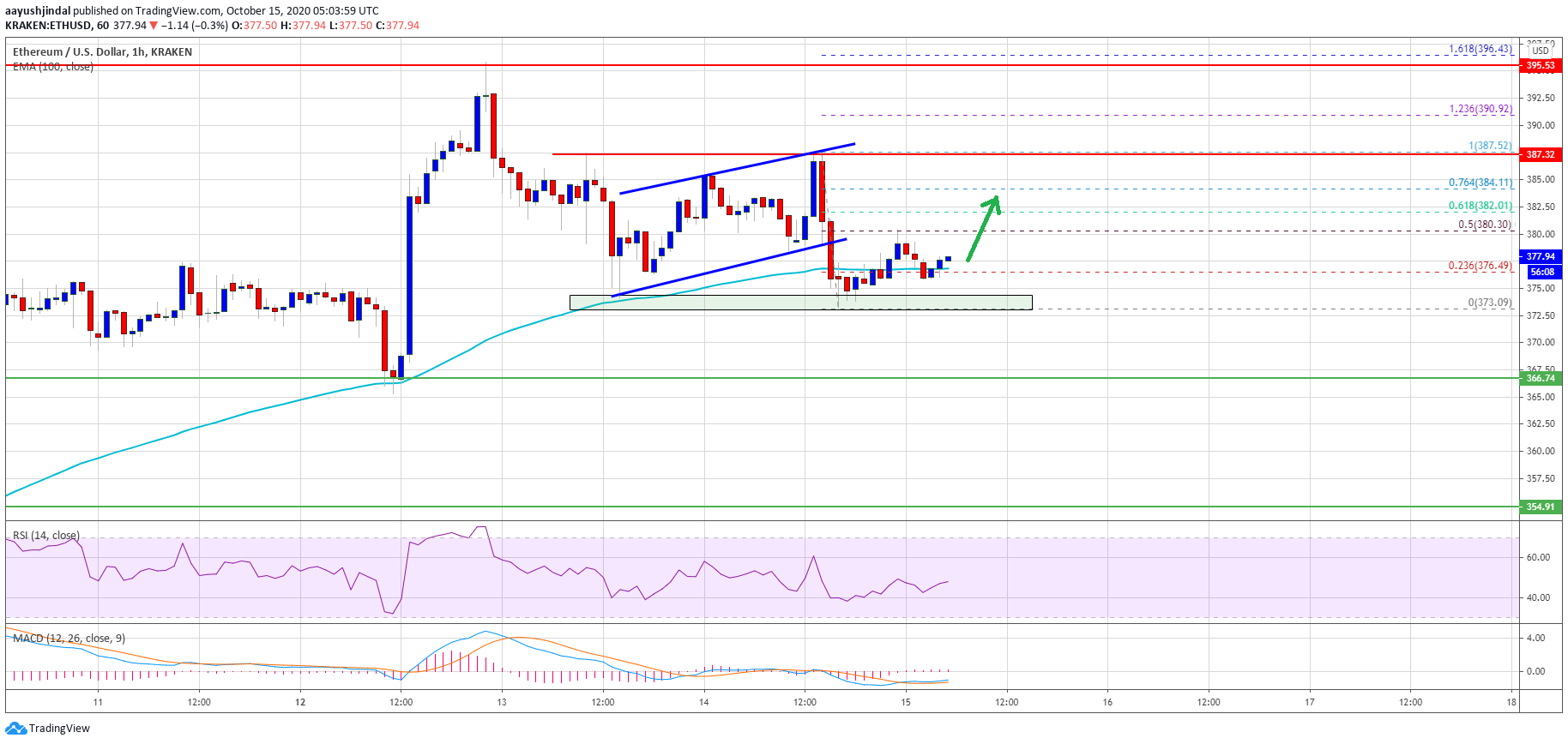 TA: Ethereum Looks Ready For Another Leg Higher Unless It Dives Below $365