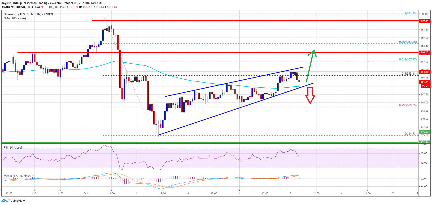 Ethereum Reaches Crucial Resistance: Technicals Hint A 5% pullback is Likely