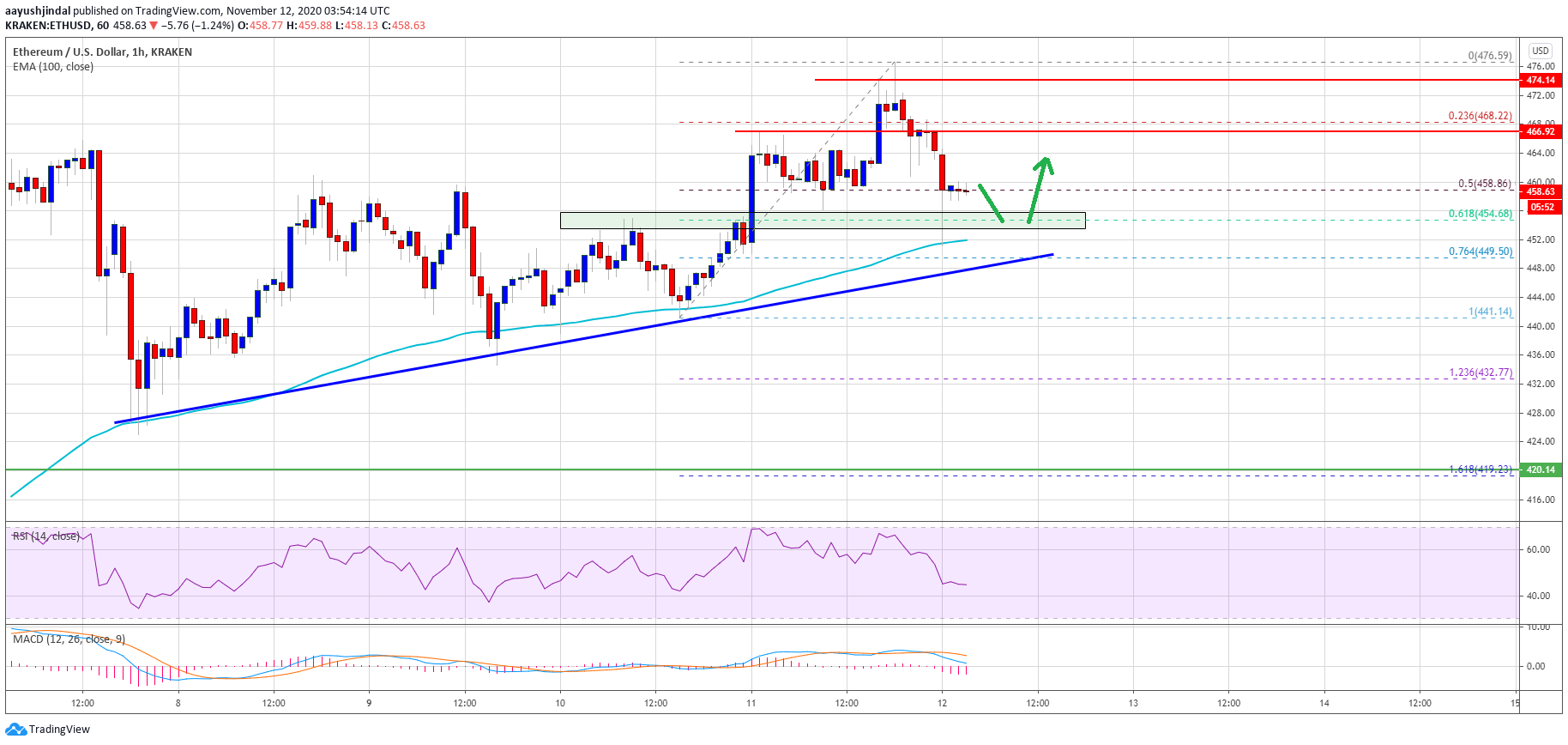 TA: Ethereum Bulls Keeps Pushing, Why Rally Isn’t Over Yet
