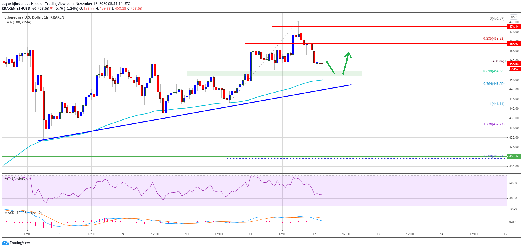 Ethereum price