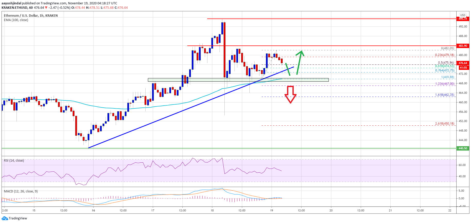 TA: Ethereum Struggles Below $485, Why 100 SMA Is The Key