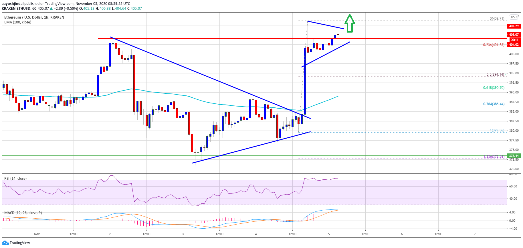 TA: Ethereum Prints Bullish Breakout, A Strengthening Case For $425