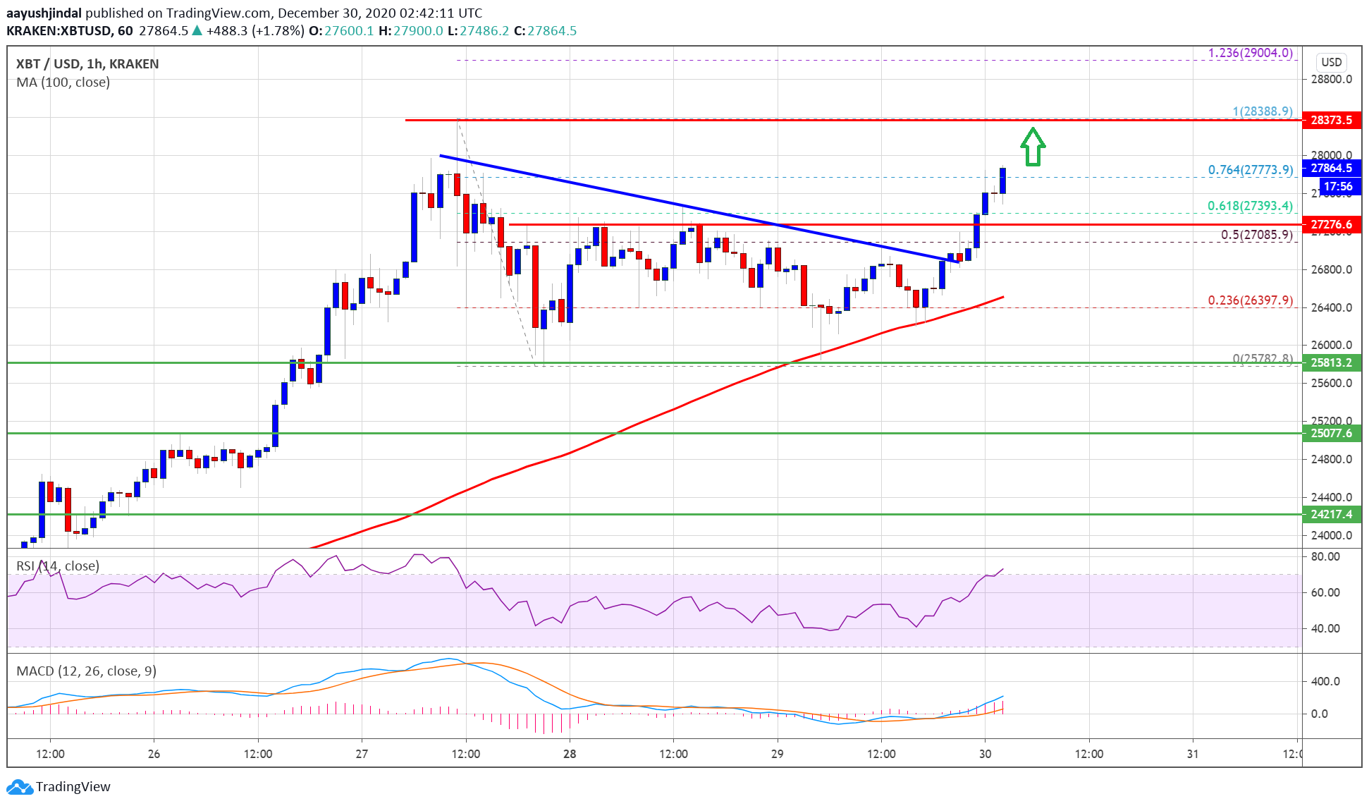 TA: Bitcoin Price Regains Strength, Why BTC Could Surge To $30K