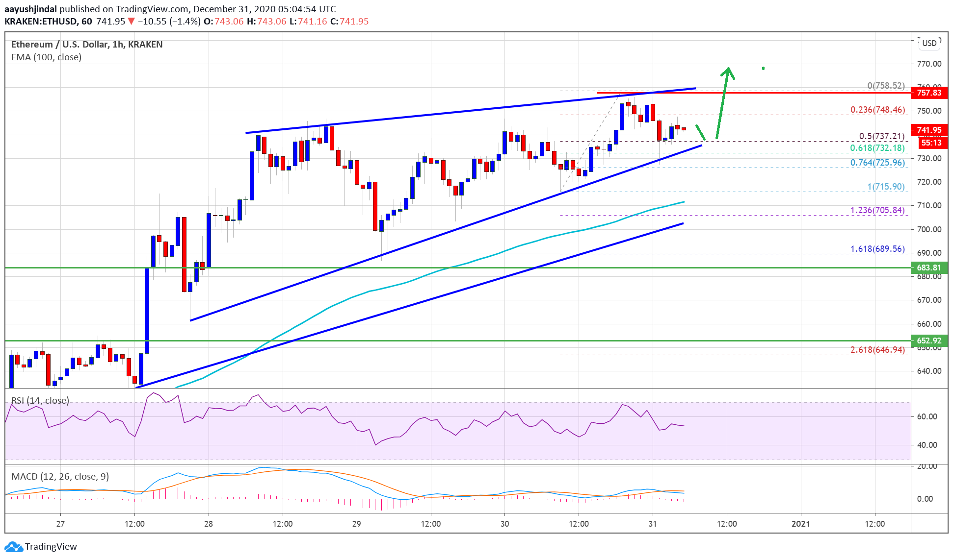 TA: Ethereum Prints Bullish Pattern, Why ETH Looks Set To Clear $750