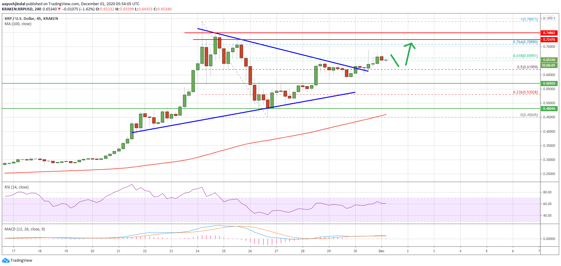 Charted: Ripple (XRP) Signaling Sharp Increase To $0.72 In Near-Term