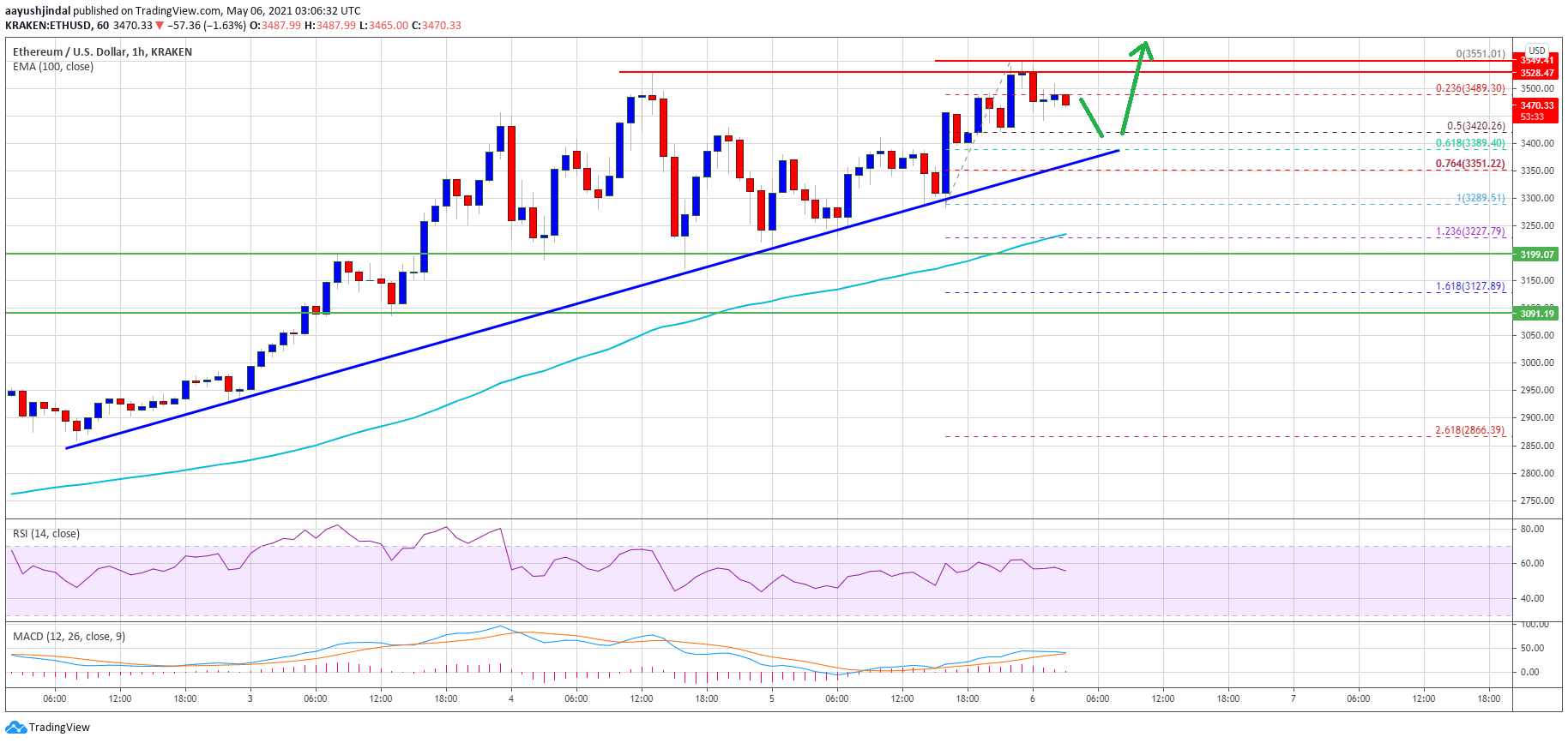 TA: Ethereum Sets New ATH, Why Dips Remain Attractive In Near-Term