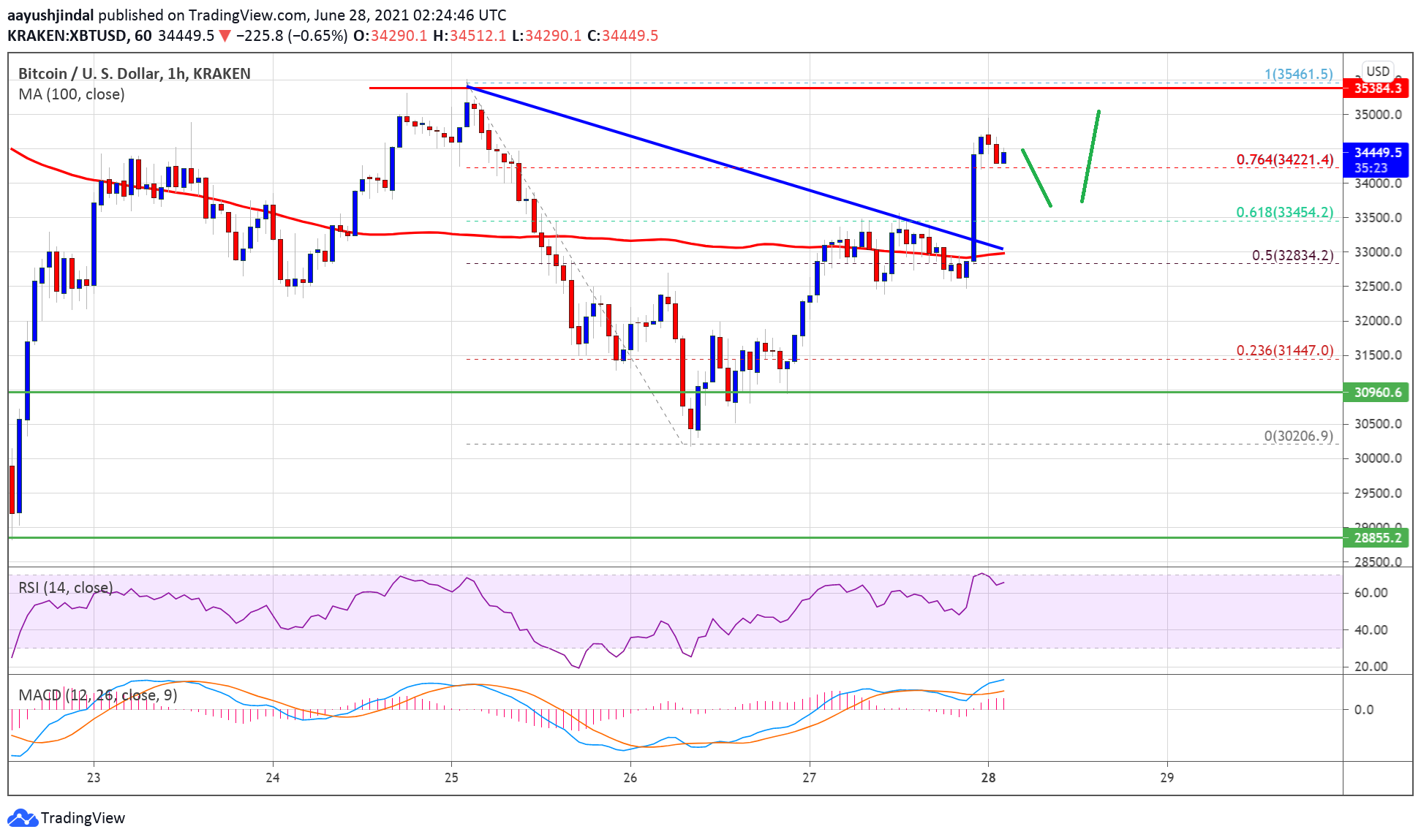 TA: Bitcoin Gains Traction, Why BTC Could Target Fresh High Above $35K