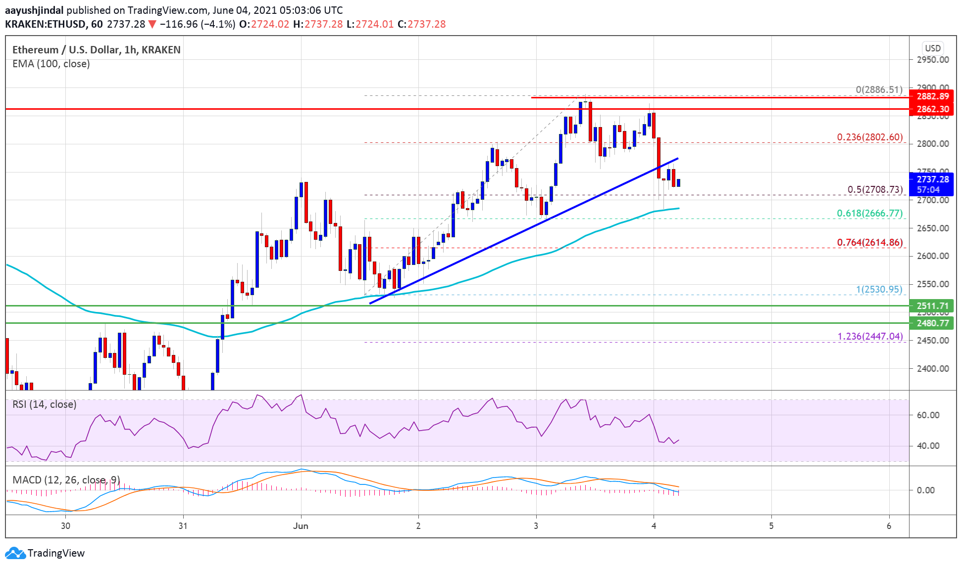 TA: Ethereum (ETH) Corrects Lower, Why 100 SMA Could Trigger Fresh Rally