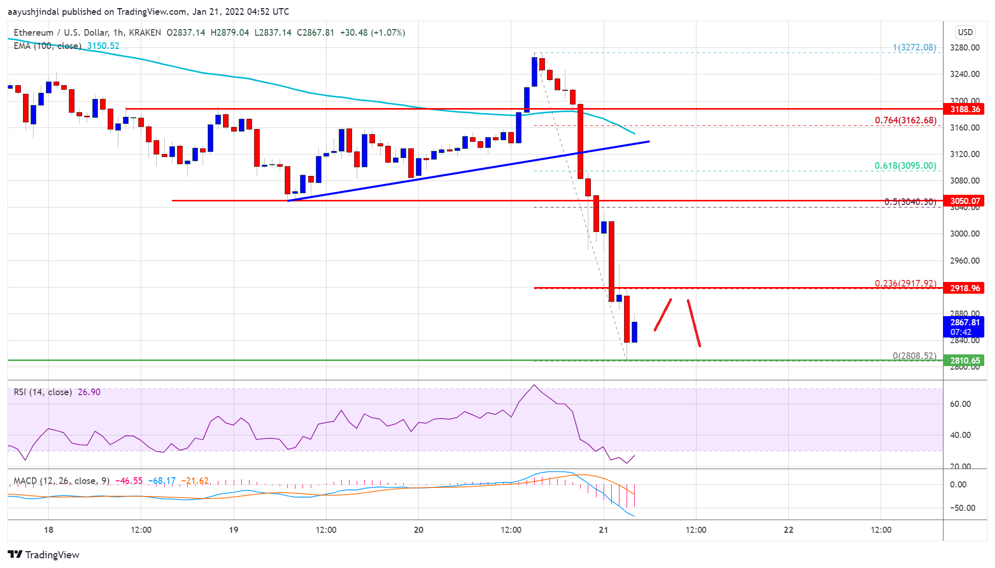 سعر Ethereum