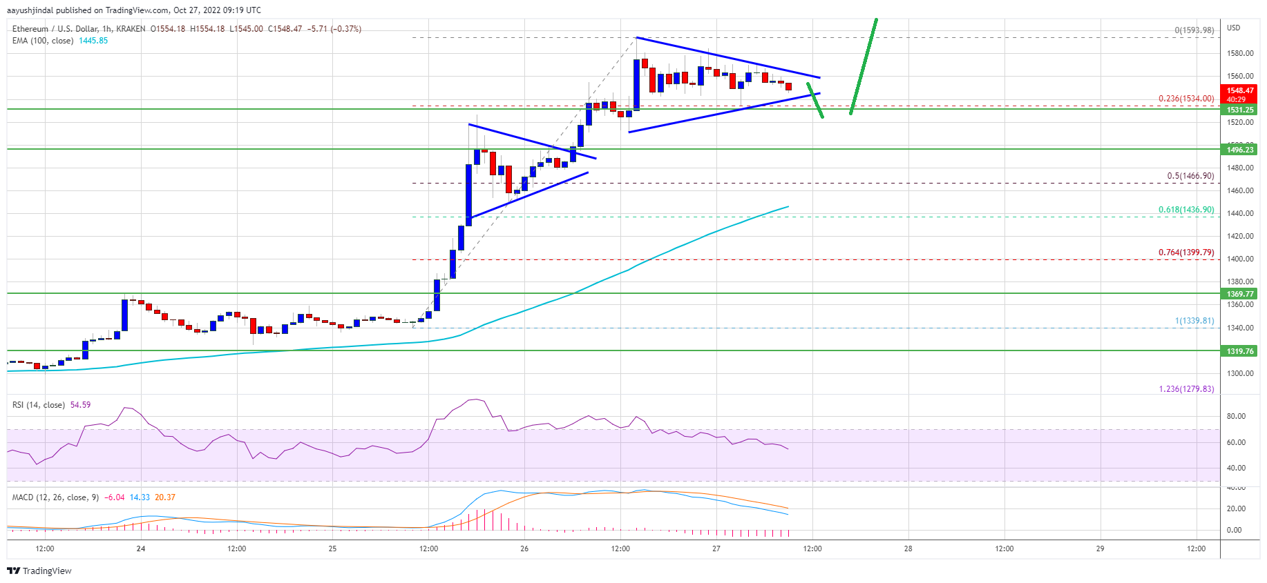 Ethereum Price Holds Strong at $1,500: A Strengthening Case for Upside