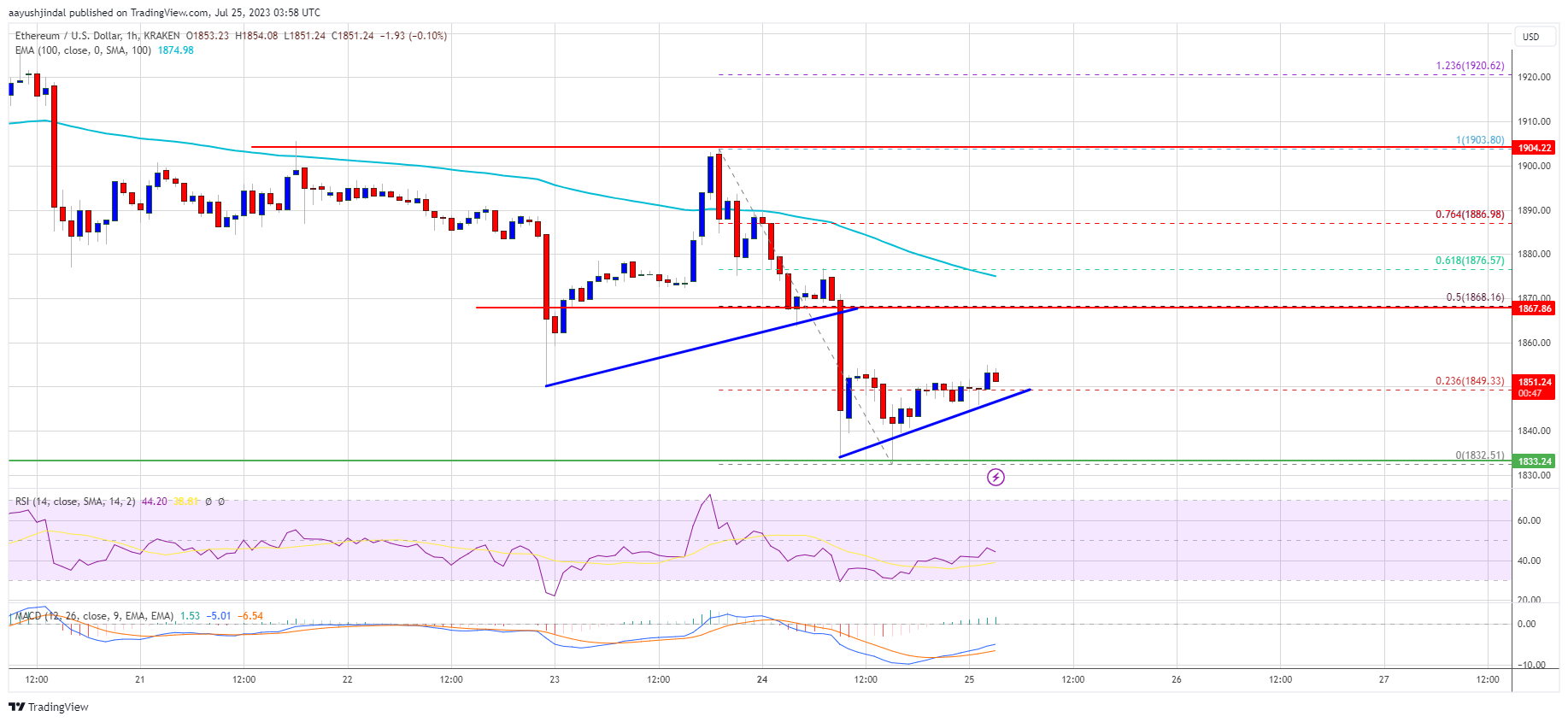Ethereum Price Struggles Below ,900 – Can Bulls Save the Day?