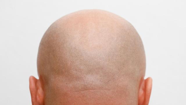 All Hype? BALD Meme Coin’s Volume Shaved By 96%
