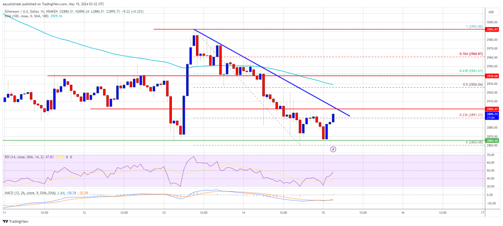 Ethereum Price Anticipates Upside Break To Shift Sentiment Towards Bullish