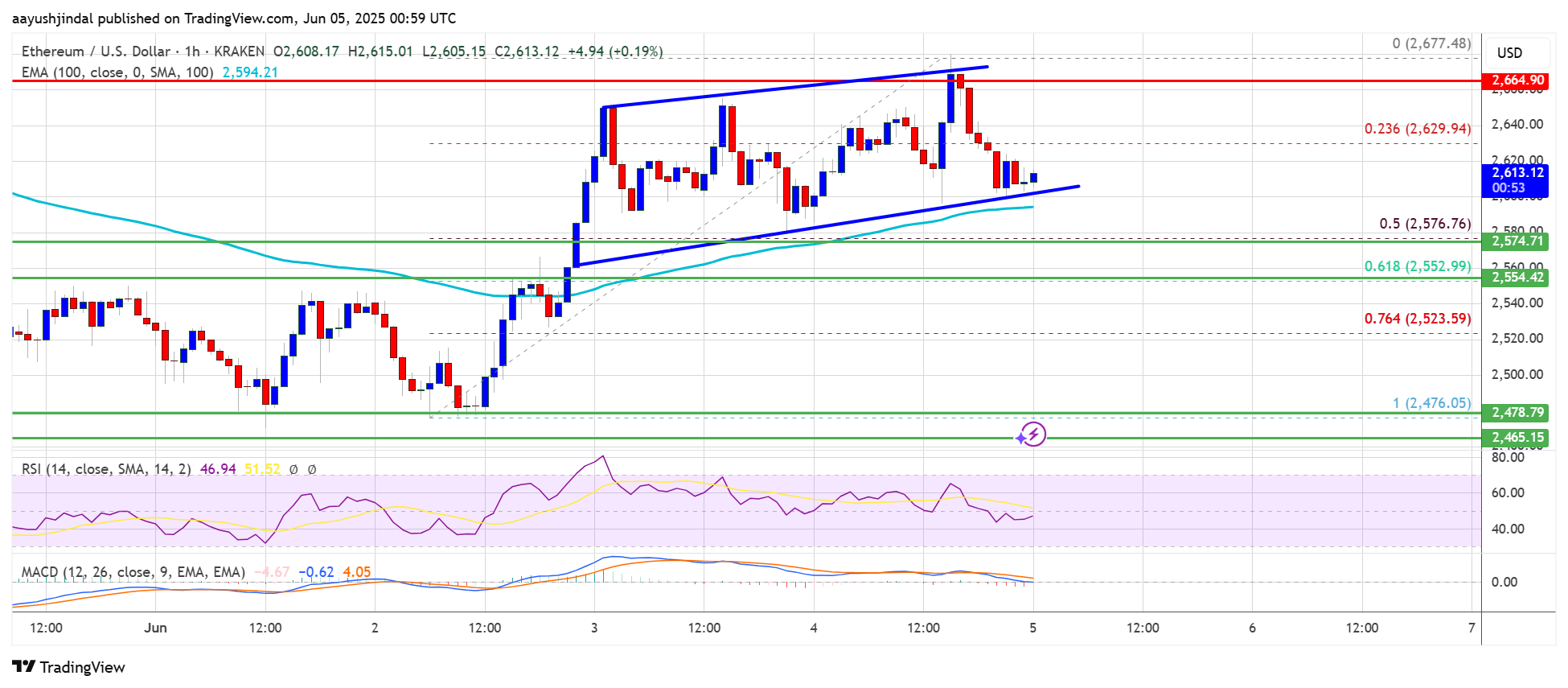 Ethereum chart, or perhaps a tragic comedy of hopes and fears