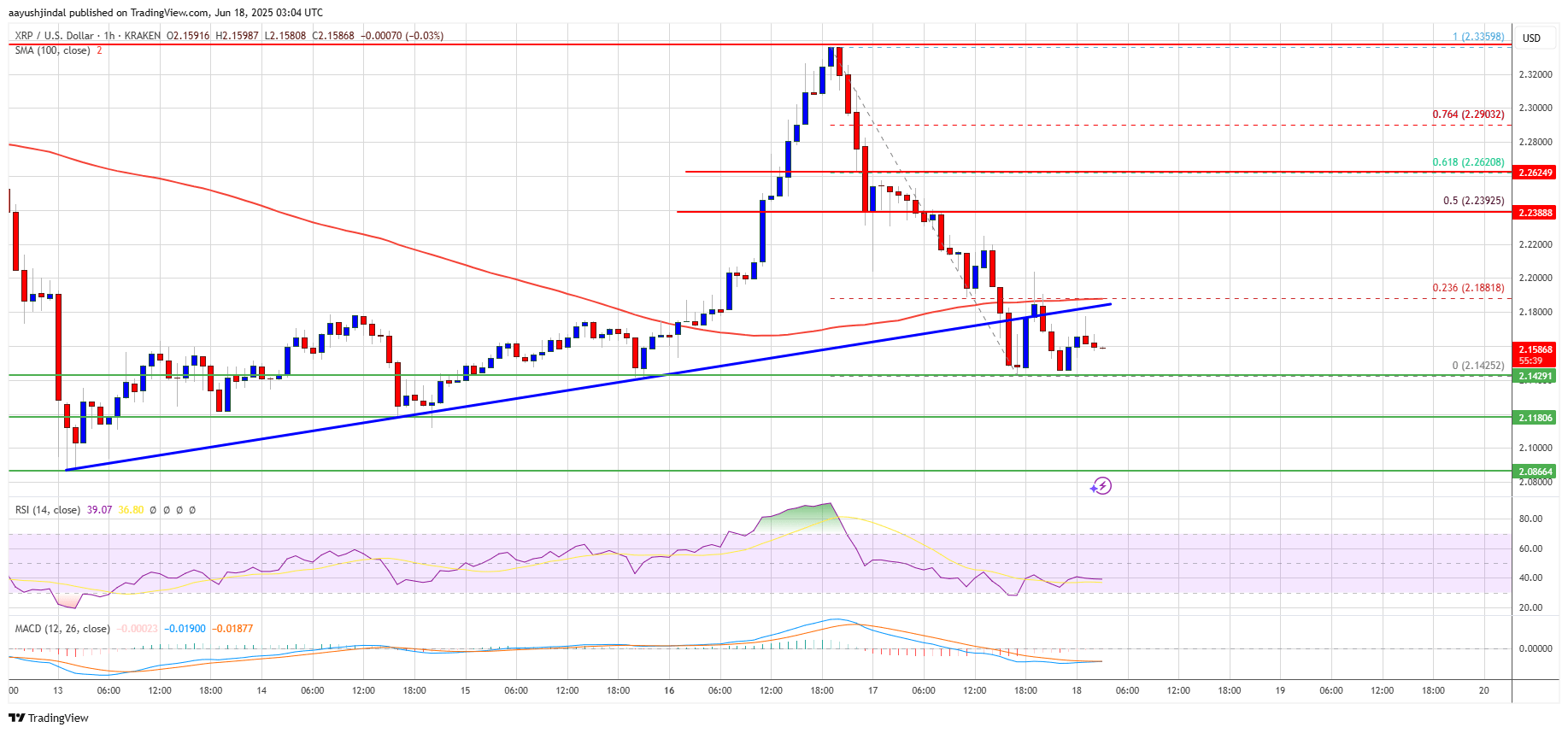 XRP Price Chart - Look at all those squiggly lines!