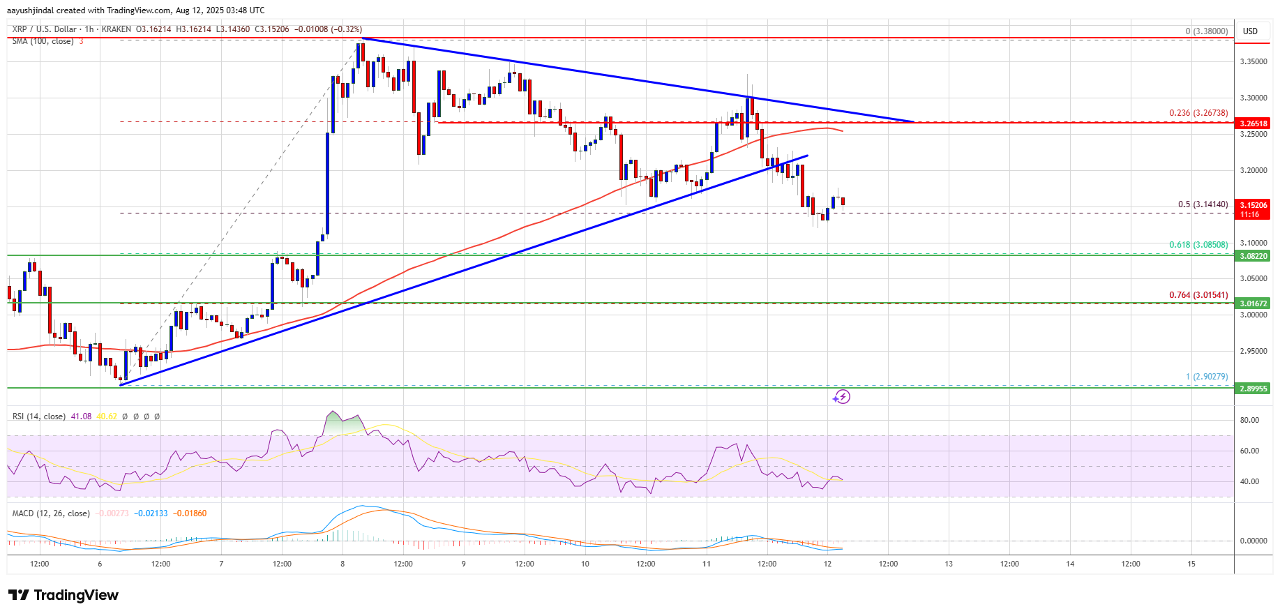 XRP Price Chart: A Rollercoaster of Emotions
