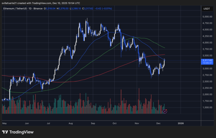 ETH testing critical resistance level | Source: ETHUSDT chart on TradingView