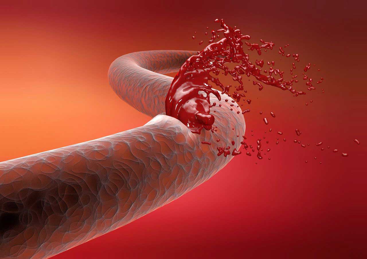 ETFs Spot Perdem $349M e Baleias Vendem: Bitcoin em Medo Extremo e Alerta de Mais Baixa